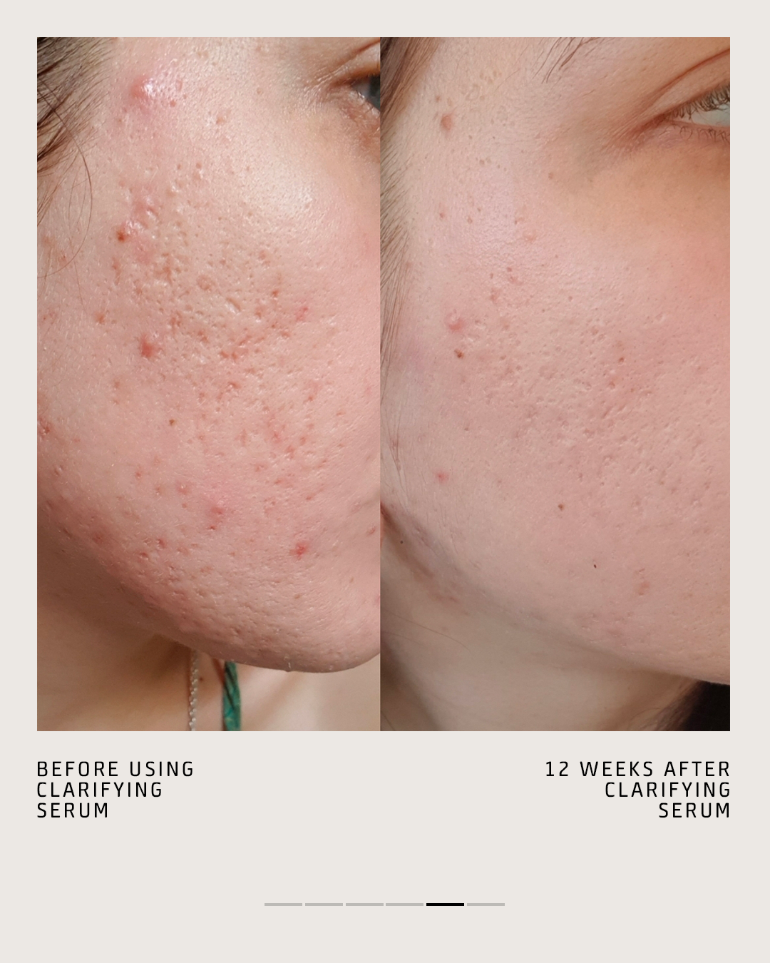CLARIFYING SERUM