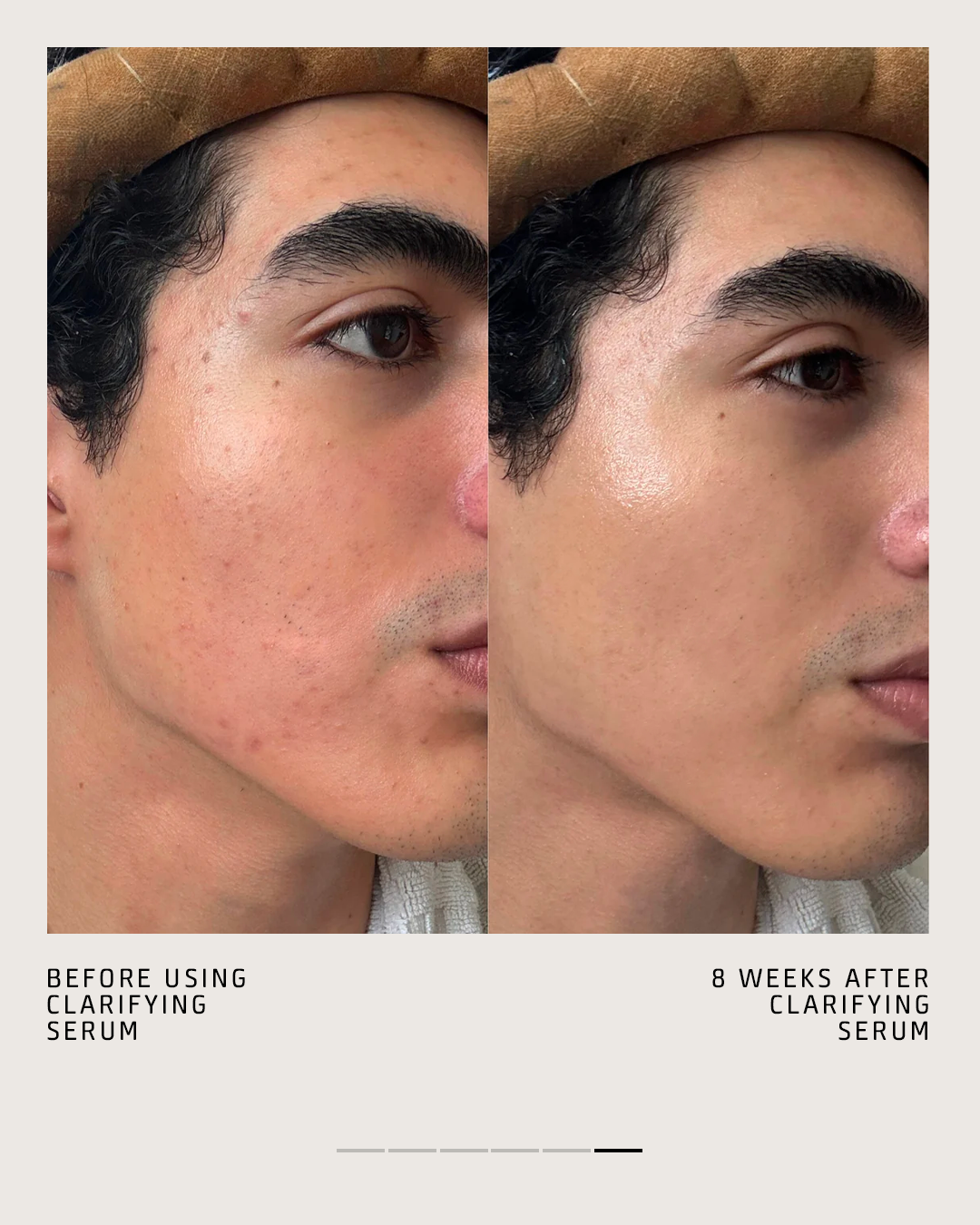CLARIFYING SERUM