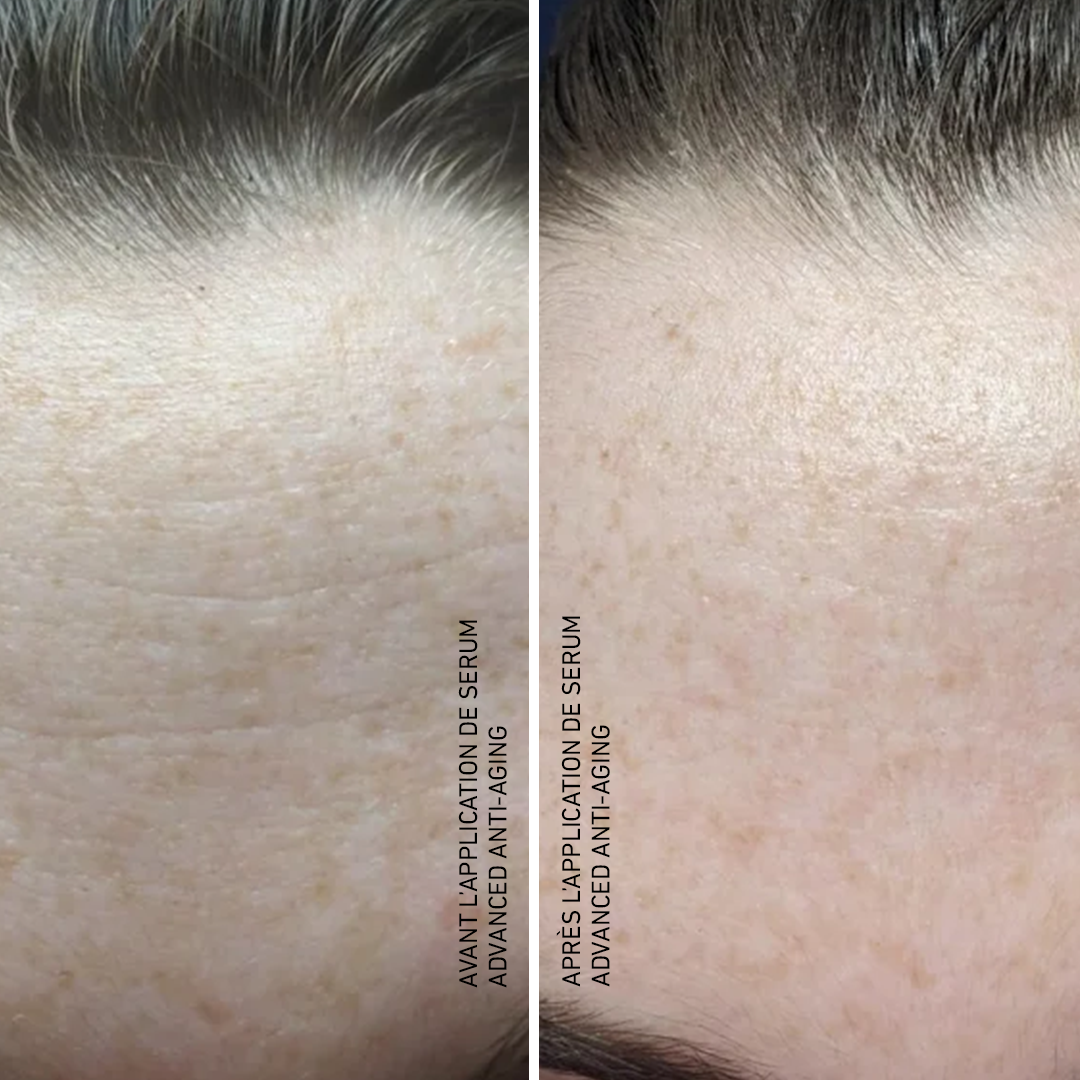 Advanced Anti-Aging
