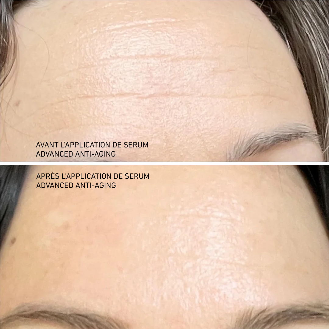 Advanced Anti-Aging