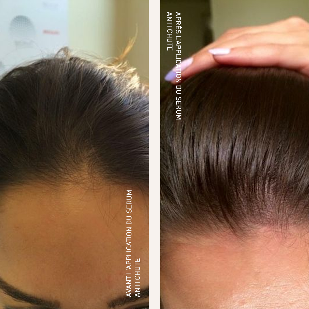 Hair loss control