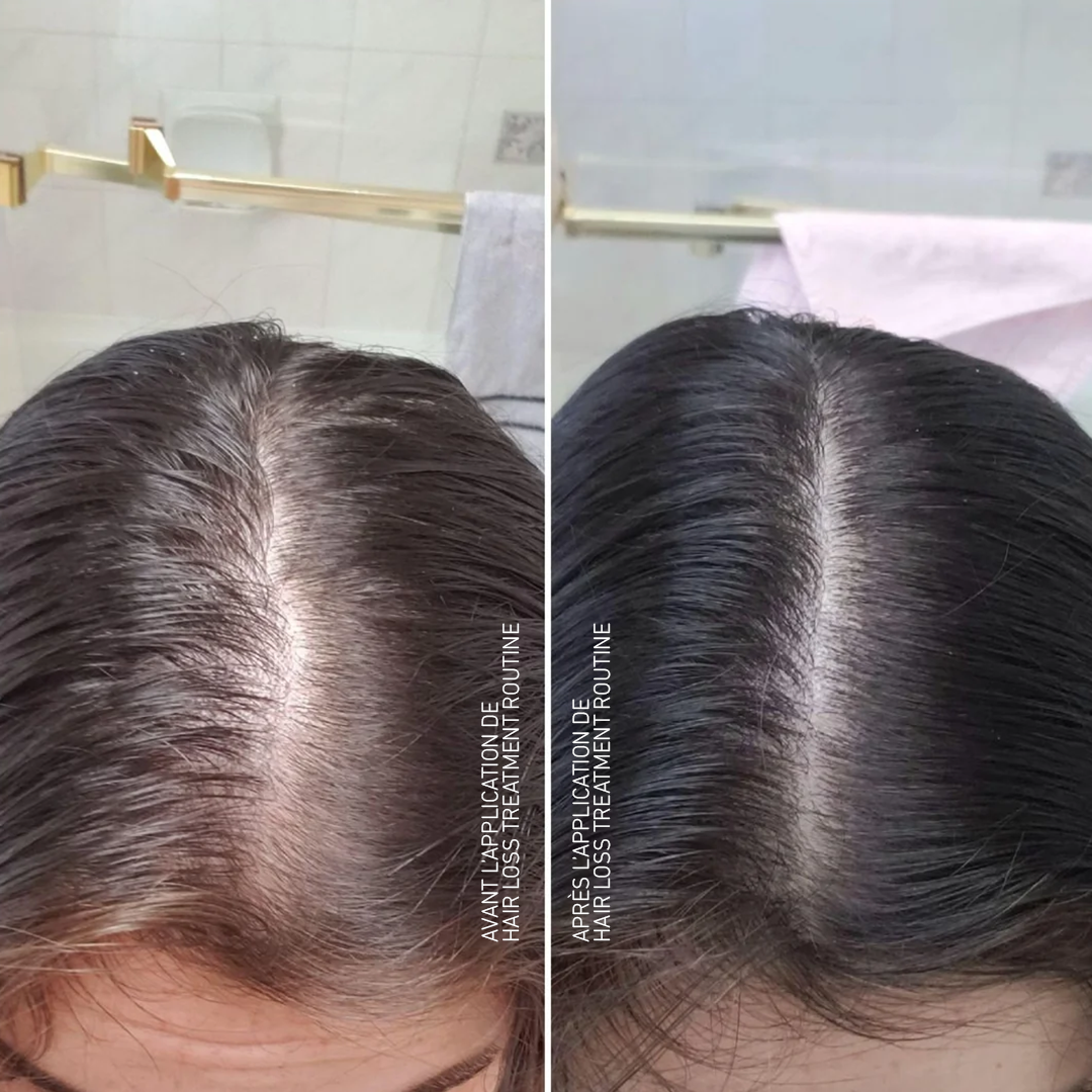 Hair Loss Treatment Routine